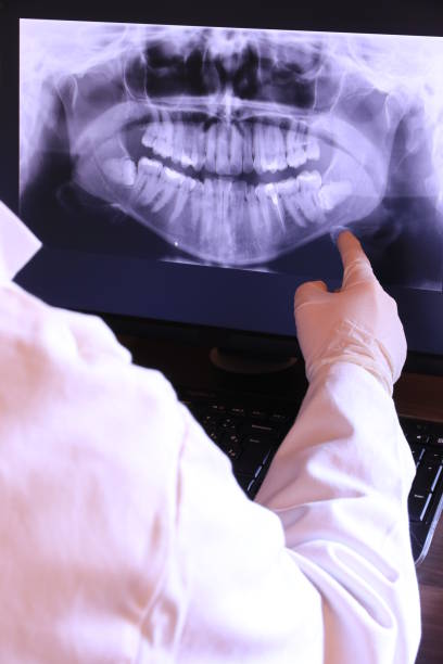 Best Emergency Tooth Extraction in Le Mars, IA