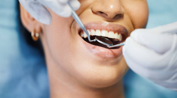 Best Emergency Root Canal Treatment in Le Mars, IA